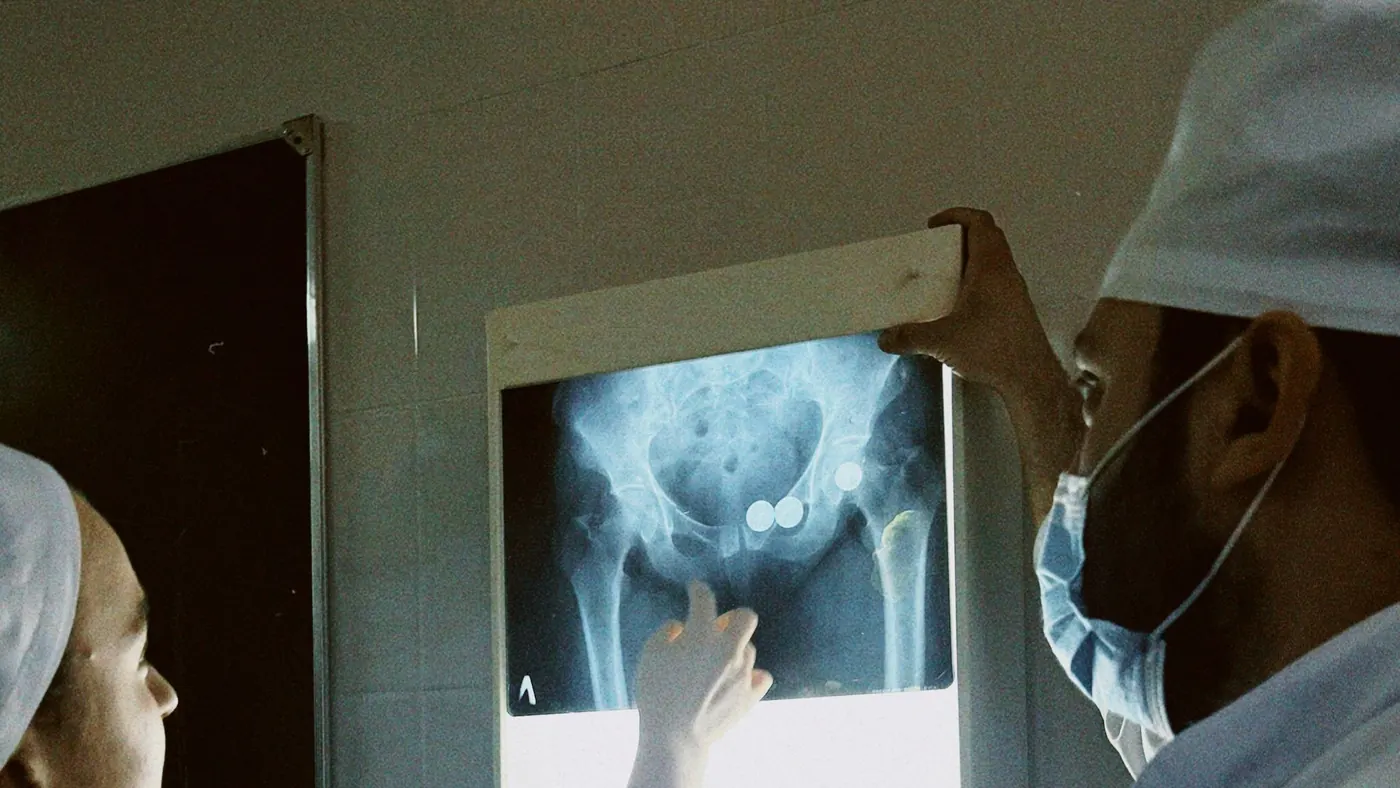 Two doctors in masks studying a hip X-ray on a lit viewing screen